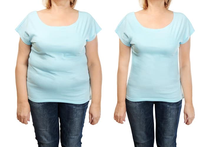 Pros and Cons of Weight Loss Surgery for Liver Health